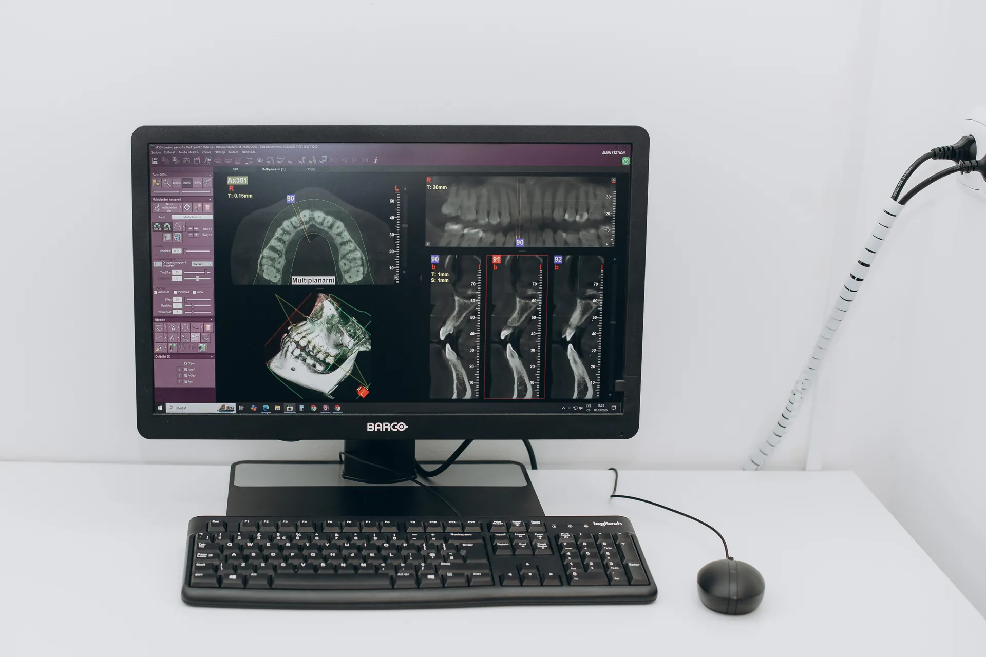 CBCT (3D rentgen)